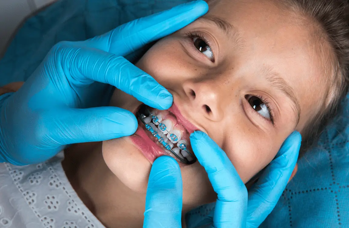 Teeth Filing